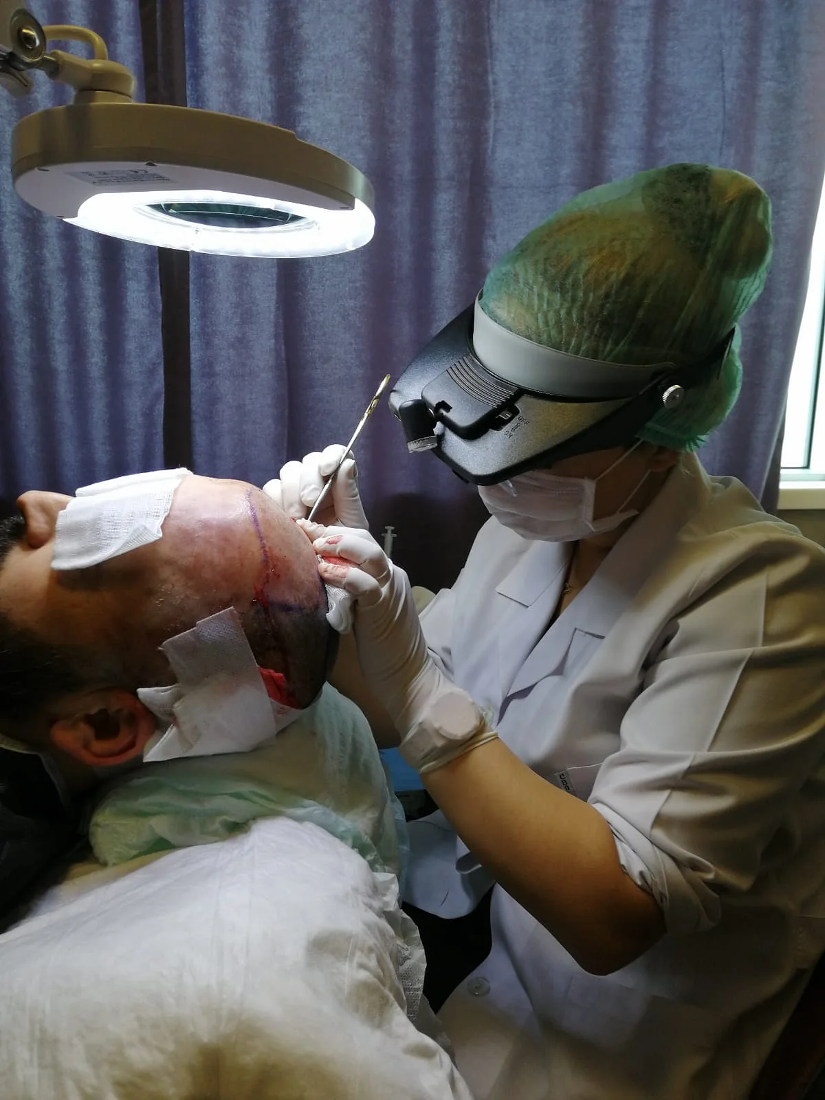 Hair transplant graft placement in an Istanbul treatment room